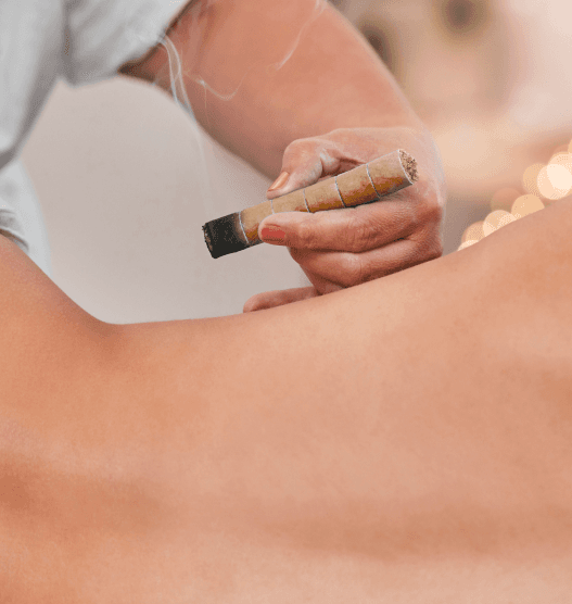 Cupping therapy treatment
